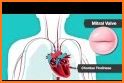 Auscultation ( Heart & Lung Sounds) related image