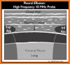 FULL ULTRASOUND GUIDE related image