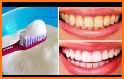 Teeth Cleaning Tips related image