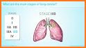 Lung Cancer Stage related image