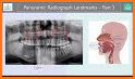 Dental Panoramic Radiology related image