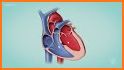 Pocket Tutor: Heart Disease related image