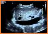 ULTRASOUND MASTER I related image