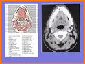 Interactive CT and MRI Anatomy related image