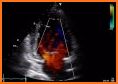 FULL ULTRASOUND GUIDE related image