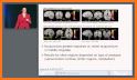 Neuro Imaging related image