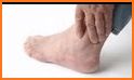 Gout related image