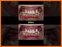 Dentist & Braces doctor - Mouth care surgery related image