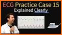 Medicos ECG :Clinical Guide & Daily EKG/ ECG Cases related image