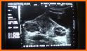 Abdominal Ultrasound pc related image