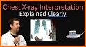 Chest X-Ray And Pathology related image