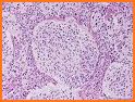 Pathology Review Quiz related image