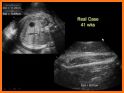 Radiology Measurements related image