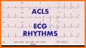 Electrocardiogram ECG Types related image