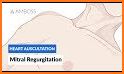 Auscultation - Heart, Lung Sounds, Cardiac Murmurs related image