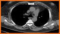 CT Scan Cross Sectional Anatomy related image