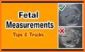 Fetal calculator PRO related image