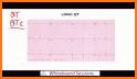 Electrocardiogram (ECG) Rhythm App: Corrected QT related image