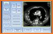 Protocolos Tomografía Helicoidal Multicorte related image