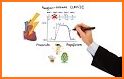 Arrhythmias and Dysrhythmias related image