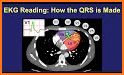 QRs related image