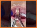 Animal Dentist Tooth Surgery 🦷 - Child Doctor related image