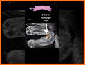 ScanBaby learn baby ultrasound related image