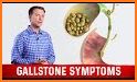 Gallstone Disease: Causes, Diagnosis,and Treatment related image