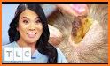 Dr. Pimple Popper related image