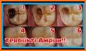 tips simpel makanan agar gigi anak selalu sehat related image