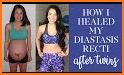 Diastasis Recti Exercises related image