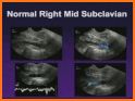 MSK ultrasound Upper Limb related image