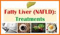 Fatty Liver (NAFL) related image