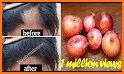 Hair fall control and growth related image