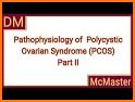 PCOS (Polycystic Ovary Synd.) related image