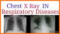 Chest X-Ray And Pathology related image