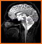 Atlas of MRI Brain Anatomy related image