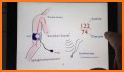 blood pressure measure results related image