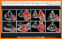 ECHOCARDIOGRAPHY GUIDE related image