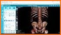 Dicom Viewer related image