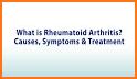 Arthritis: Causes, Diagnosis, and Treatment related image