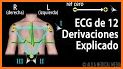 Electrocardiograma ECG Tipos related image