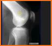 musculoskeletal x-ray interpretation related image