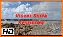 Visual Snow related image