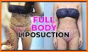 Body Plastic Surgery related image