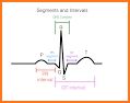 ECG in Motion – The innovative ECG education-tool related image