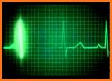 Heart Beat Monitor related image