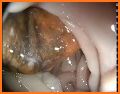 Endoscopy in Dogs related image