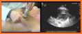 LEARN THE FULL TTE ECHO ULTRASOUND PROTOCOL DEMO related image