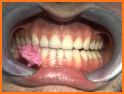 Mastication related image